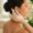 Women getting acupuncture for fertility