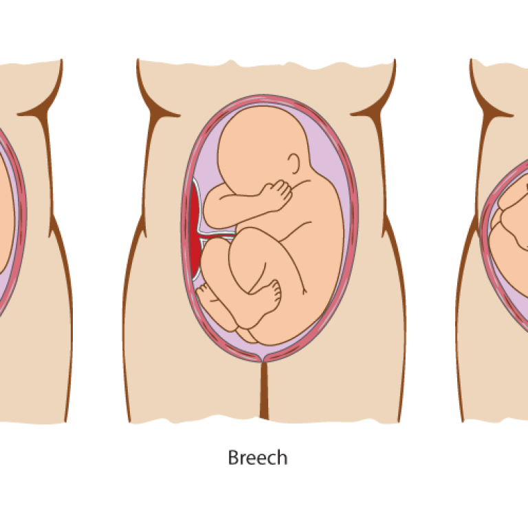 Baby positions in pregnancy