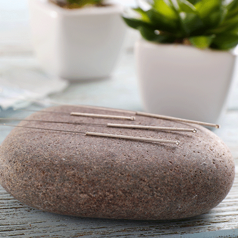 Vancouver acupuncture pregnancy